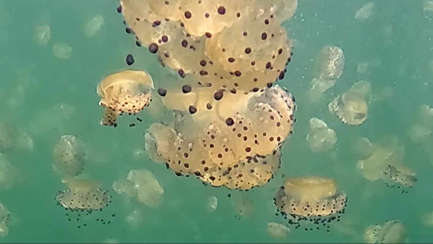 Anoxia. A Constant Prelude